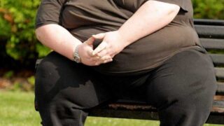 Морбидное ожирение: клинические рекомендации, лечение самостоятельно